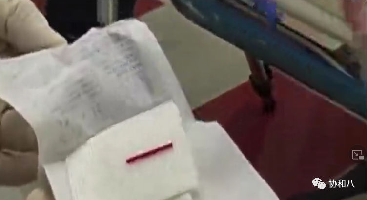 骨髓针是什么给你一次深入骨髓的记忆 ｜ 协和八_https://www.jmylbn.com_新闻资讯_第8张