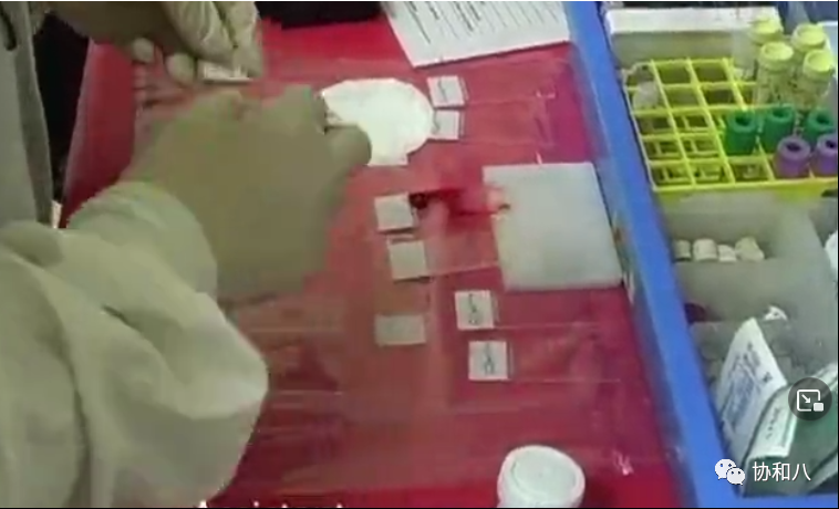 骨髓针是什么给你一次深入骨髓的记忆 ｜ 协和八_https://www.jmylbn.com_新闻资讯_第7张