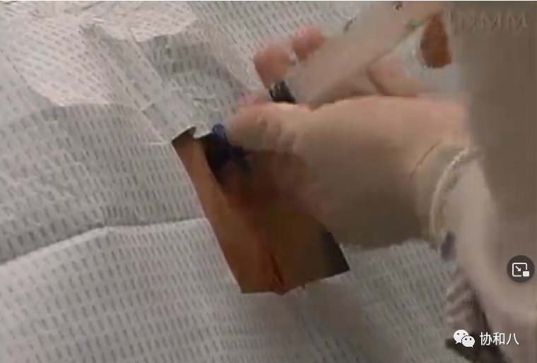 骨髓针是什么给你一次深入骨髓的记忆 ｜ 协和八_https://www.jmylbn.com_新闻资讯_第2张