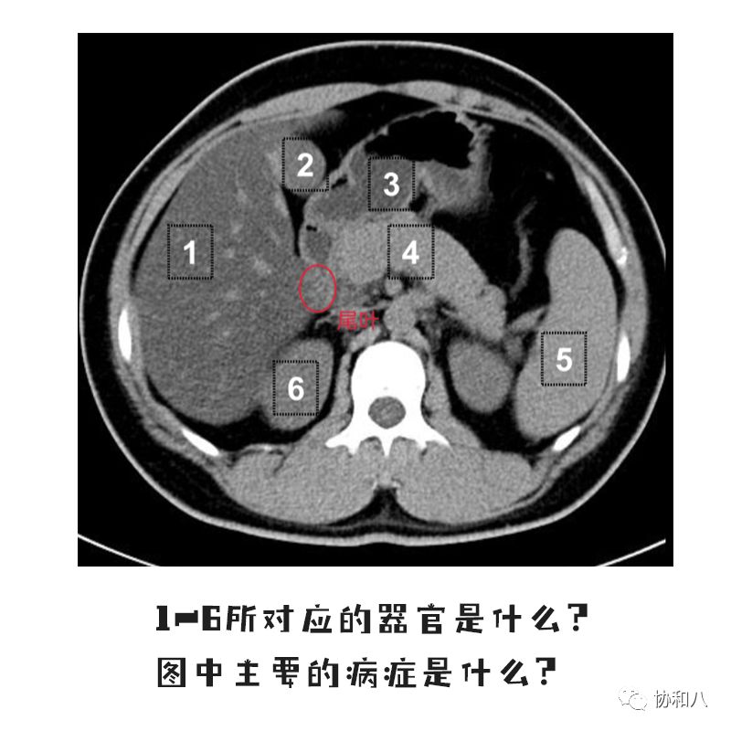 β受體阻滯劑|協和八·每日一題 健康 第2張