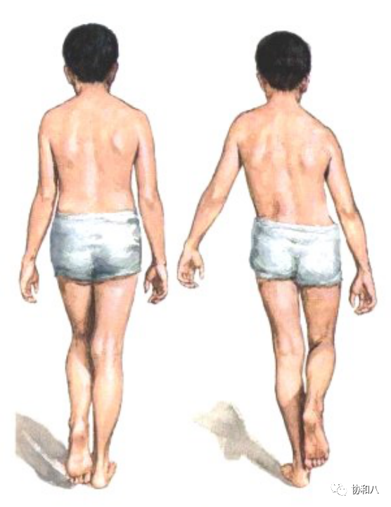 医用脱毛剂是什么腿毛比头发多，怎么办在线等！｜协和八_https://www.jmylbn.com_新闻资讯_第8张