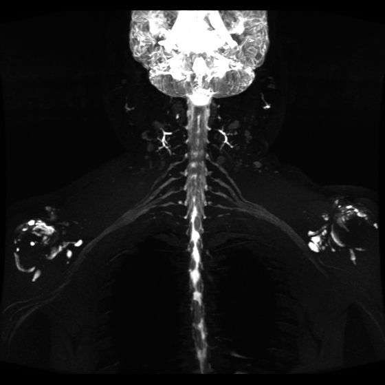 联影磁共振怎么样开启高精度诊断新模式！联影光梭3.0T磁共振落户周口市中心医院_https://www.jmylbn.com_新闻资讯_第10张