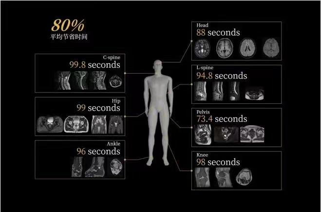 联影磁共振怎么样开启高精度诊断新模式！联影光梭3.0T磁共振落户周口市中心医院_https://www.jmylbn.com_新闻资讯_第3张