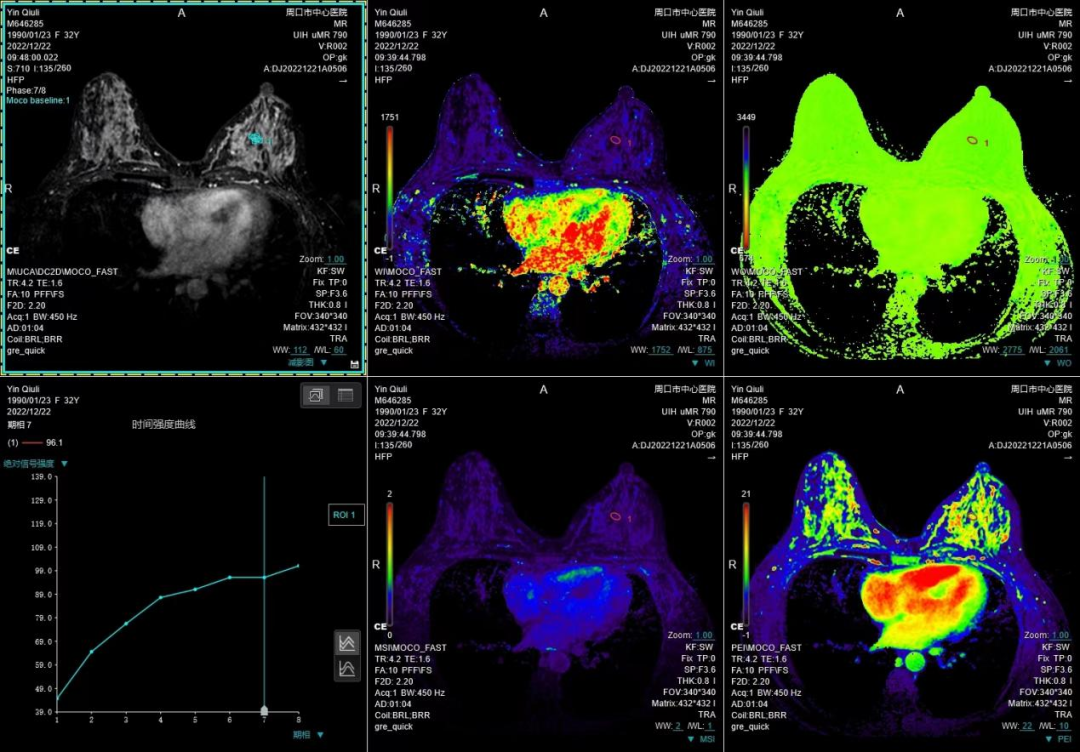 联影磁共振怎么样开启高精度诊断新模式！联影光梭3.0T磁共振落户周口市中心医院_https://www.jmylbn.com_新闻资讯_第6张