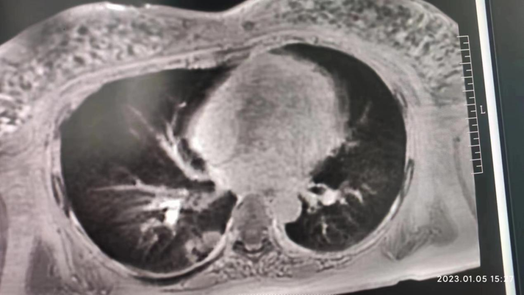 联影磁共振怎么样开启高精度诊断新模式！联影光梭3.0T磁共振落户周口市中心医院_https://www.jmylbn.com_新闻资讯_第9张