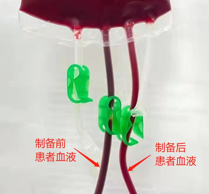 三氧疗法怎么代理千万不要做三氧疗法！一旦做了，你会后悔......_https://www.jmylbn.com_新闻资讯_第2张