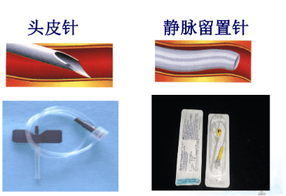 什么是安全留置针【健康科普】留置针居家护理10要点，少疼痛，更安全！_https://www.jmylbn.com_新闻资讯_第2张