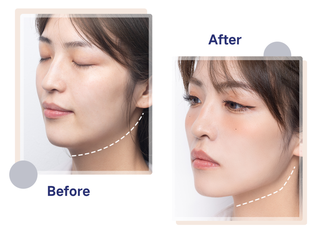 餐減肥法_減肥餐_餐減肥食譜