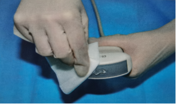 超声探头消毒用什么找茬儿（十三）｜医用超声探头的清洁消毒不能忽视_https://www.jmylbn.com_新闻资讯_第1张