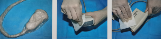 超声探头消毒用什么找茬儿（十三）｜医用超声探头的清洁消毒不能忽视_https://www.jmylbn.com_新闻资讯_第10张