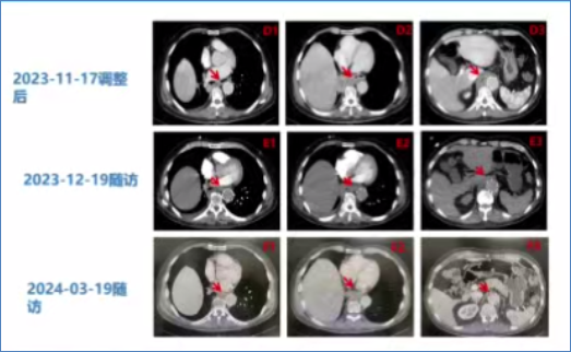 临床大查房丨反复发热半年余,拨云见日仍待续 临床大查房丨反复发热半年余,拨云见日仍待续