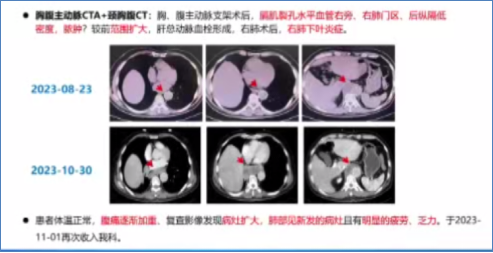 临床大查房丨反复发热半年余,拨云见日仍待续 临床大查房丨反复发热半年余,拨云见日仍待续