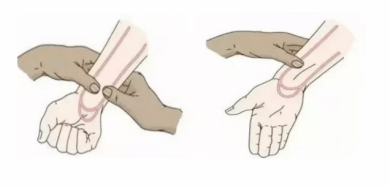 桡动脉鞘怎么读浅谈经皮桡动脉介入穿刺术的相关管理_https://www.jmylbn.com_新闻资讯_第4张