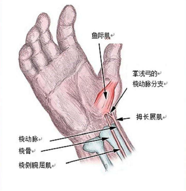 桡动脉鞘怎么读浅谈经皮桡动脉介入穿刺术的相关管理_https://www.jmylbn.com_新闻资讯_第3张