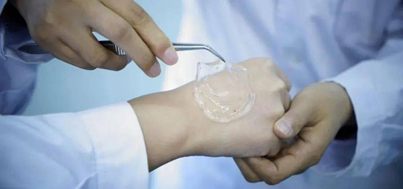 水凝胶伤口敷料怎么用浅谈水凝胶敷料的简史及其临床应用_https://www.jmylbn.com_新闻资讯_第4张