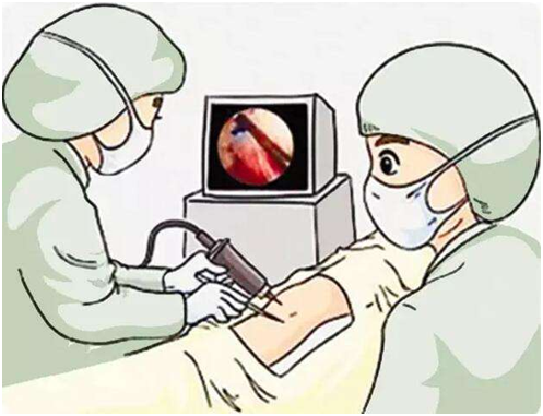 德湿银敷料怎么使用浅谈伤口清创技术及工具_https://www.jmylbn.com_新闻资讯_第5张