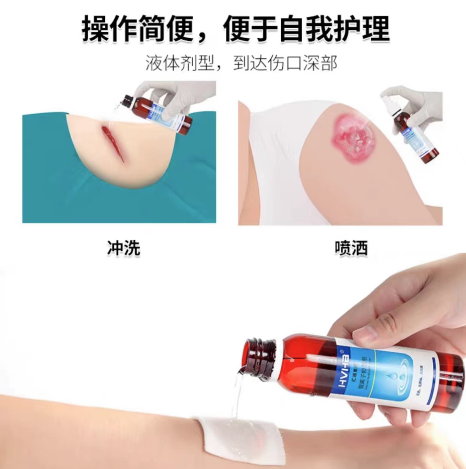 液体口腔敷料怎么用浅谈液体敷料简史_https://www.jmylbn.com_新闻资讯_第7张
