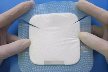 医用泡沫敷料怎么用浅谈泡沫敷料简史及其临床应用_https://www.jmylbn.com_新闻资讯_第2张