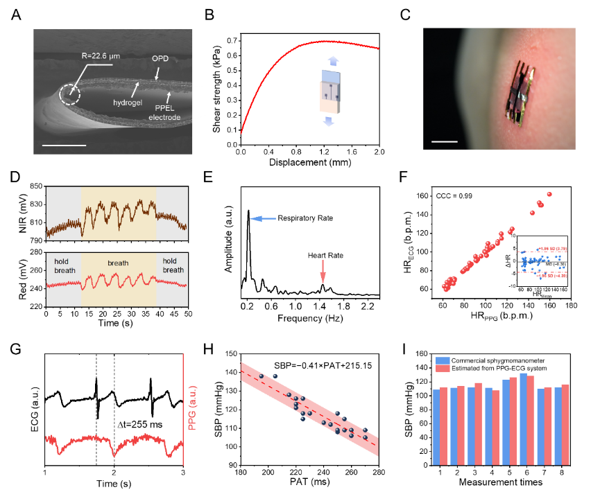 深圳怎么开通ecg清华深圳国际研究生院徐晓敏、成会明团队 Adv. Sci.：在皮肤集成电子的多模传感研究领域取得新进展_https://www.jmylbn.com_新闻资讯_第6张