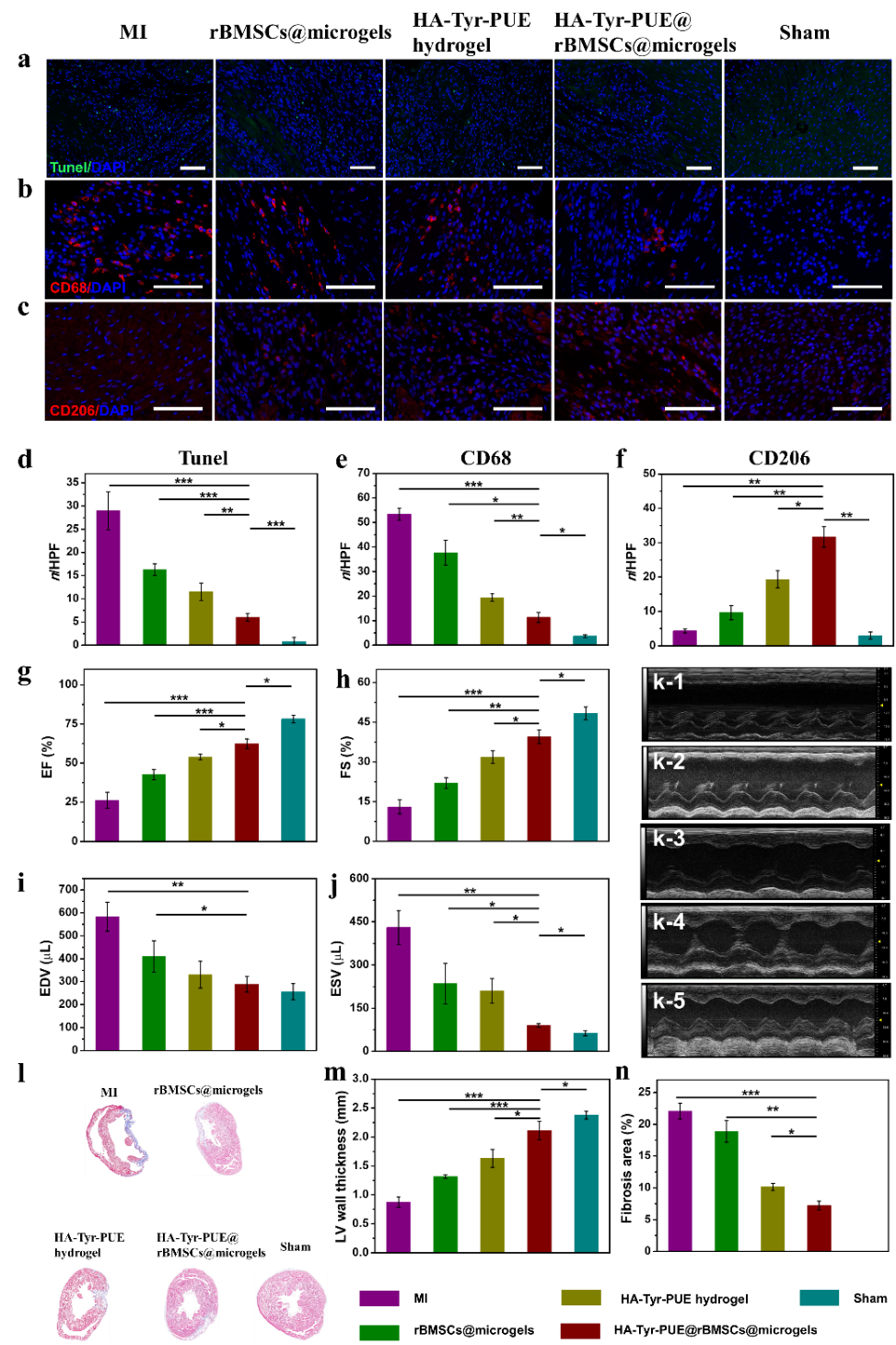 天津大学刘文广教授团队《Nano Today》：中草药交联生物大分子水凝胶携带rBMSCs@聚两性离子微凝胶治疗心肌梗死的图2