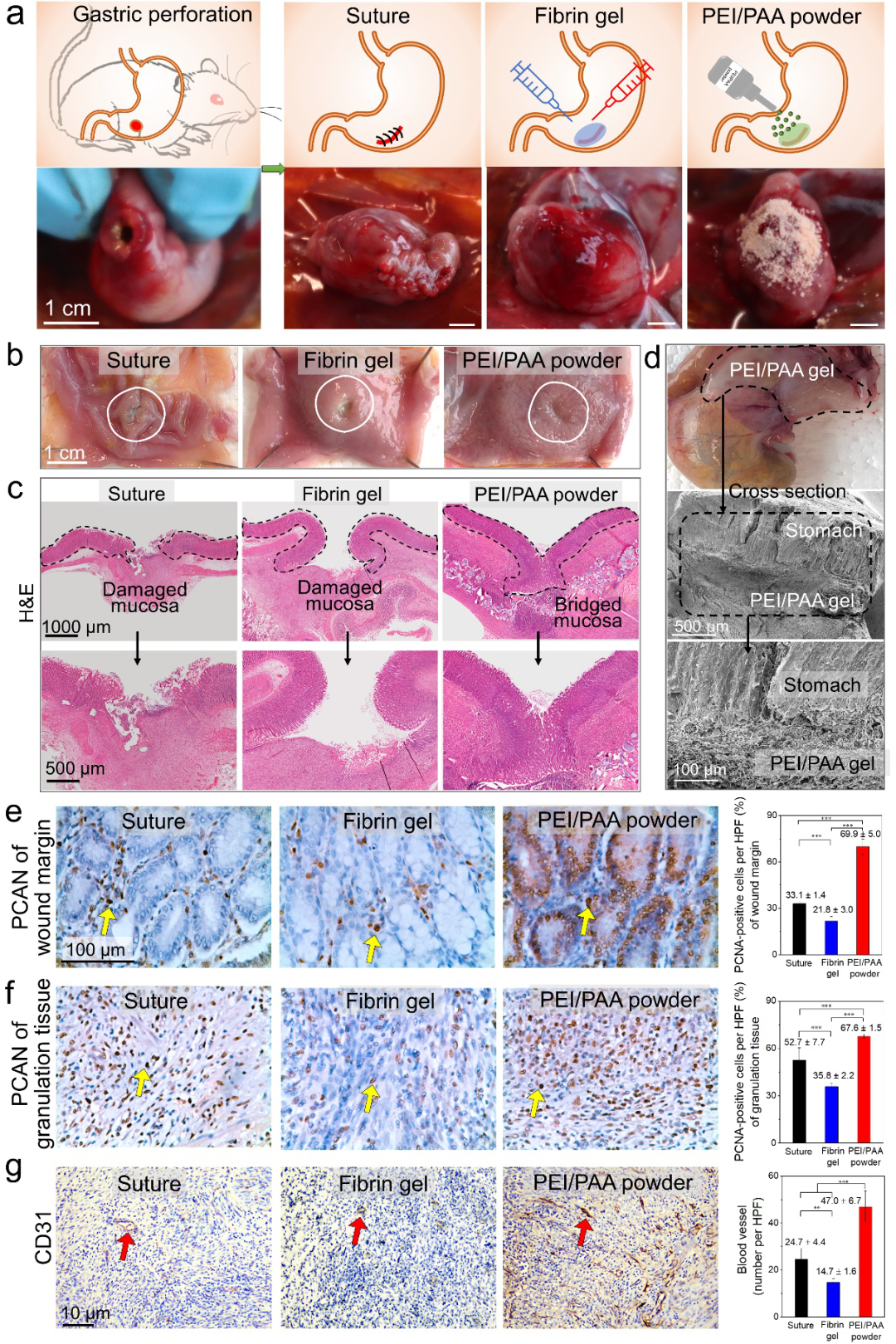 华南理工大学边黎明教授课题组《Sci. Adv.》：遇水自发形成水凝胶并在湿润动物组织表面形成强韧黏附的粉末的图3