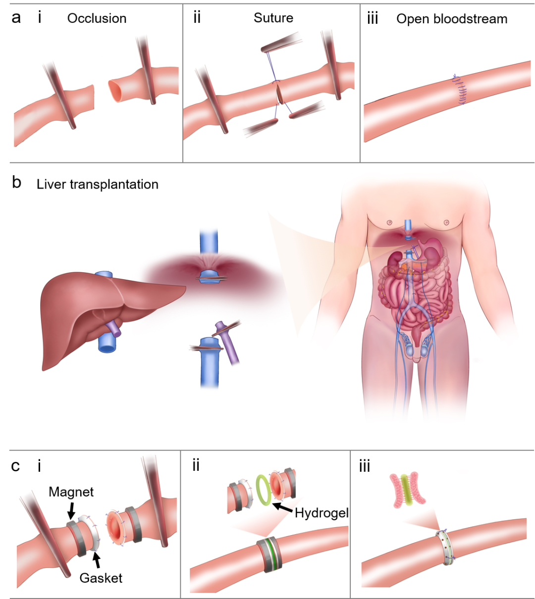 哈佛锁志刚院士与西安交大吕毅/唐敬达提出磁辅助-水凝胶粘接方法用于器官移植的图2
