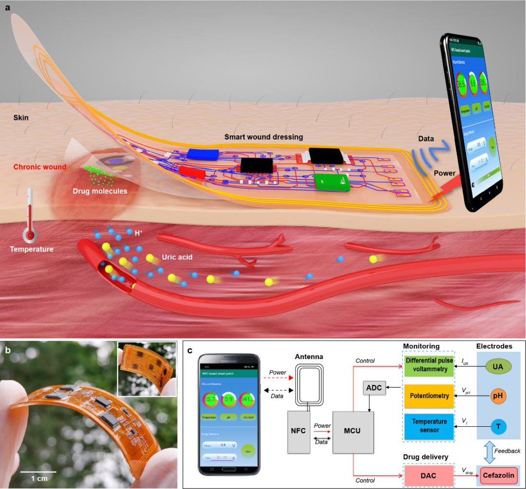 浙江大学刘清君教授课题组AFM：无线无源柔性智能伤口敷料的图1