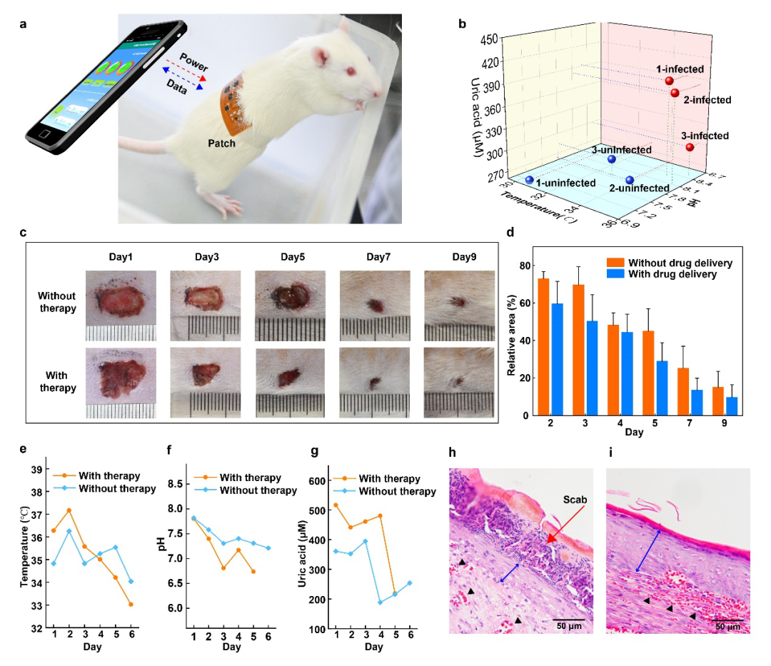 浙江大学刘清君教授课题组AFM：无线无源柔性智能伤口敷料的图5