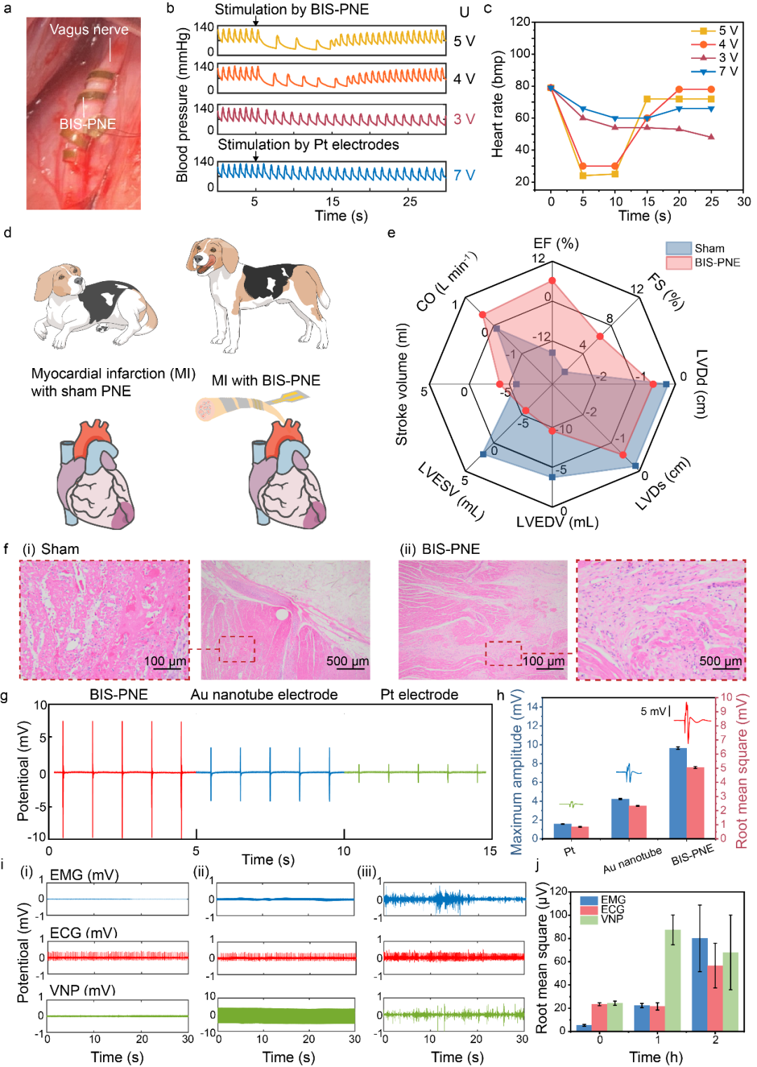 bis电极怎么接南京医科大学胡本慧团队 Adv. Sci.：体驱缓塑 - 低电压刺激延缓心脏重构进程的外周神经电极_https://www.jmylbn.com_新闻资讯_第5张