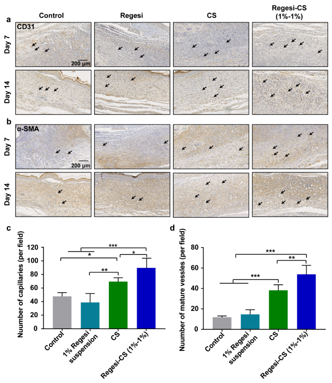 壳聚糖治什么病川大华西口腔医学院彭强研究员团队 AHM：多功能再生硅-壳聚糖水凝胶促进MRSA感染的糖尿病创面愈合_https://www.jmylbn.com_新闻资讯_第11张