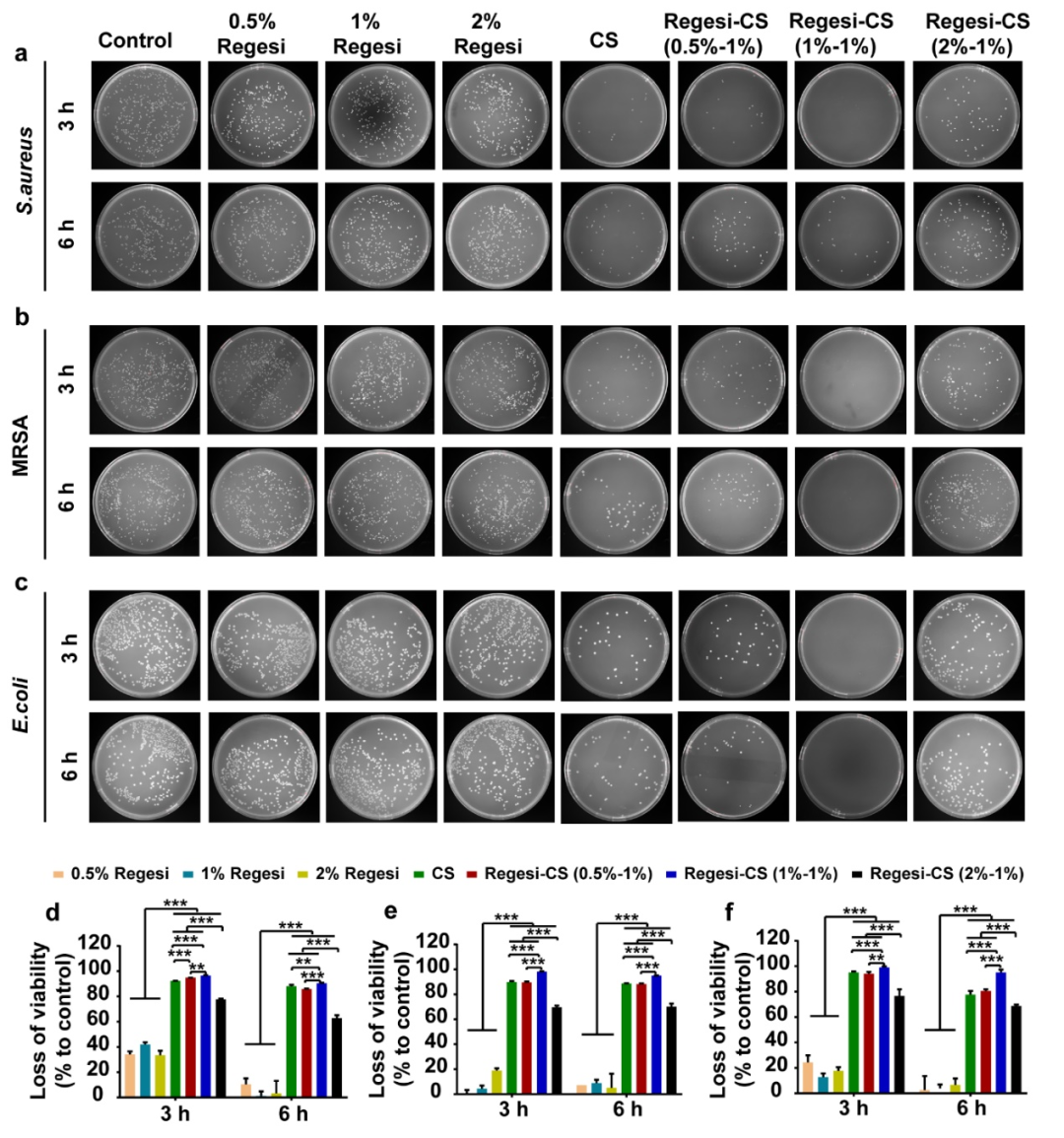 壳聚糖治什么病川大华西口腔医学院彭强研究员团队 AHM：多功能再生硅-壳聚糖水凝胶促进MRSA感染的糖尿病创面愈合_https://www.jmylbn.com_新闻资讯_第6张