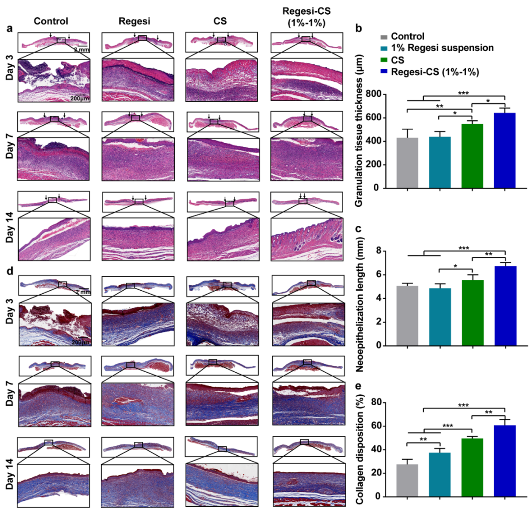 壳聚糖治什么病川大华西口腔医学院彭强研究员团队 AHM：多功能再生硅-壳聚糖水凝胶促进MRSA感染的糖尿病创面愈合_https://www.jmylbn.com_新闻资讯_第10张