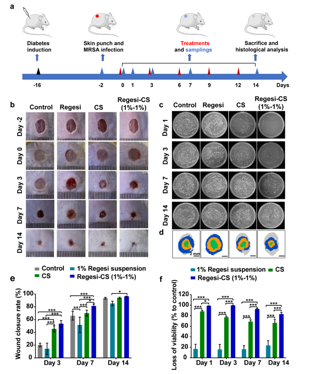 壳聚糖治什么病川大华西口腔医学院彭强研究员团队 AHM：多功能再生硅-壳聚糖水凝胶促进MRSA感染的糖尿病创面愈合_https://www.jmylbn.com_新闻资讯_第9张