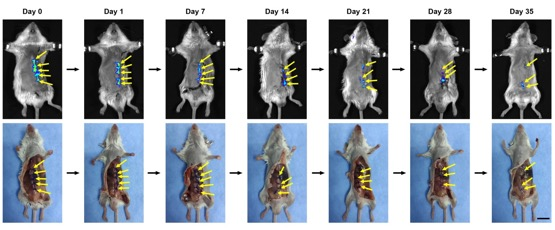 皮下缝合用什么线华南理工王琳研究员、中山六院王辉、王怀明团队 Adv. Mater.：具有抗菌性能和皮下可监测性能的AIE纳米纤维功能化缝合线_https://www.jmylbn.com_新闻资讯_第5张