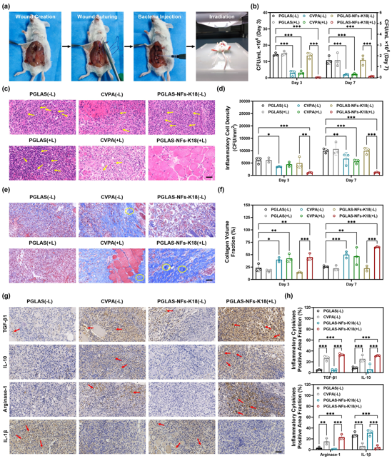 皮下缝合用什么线华南理工王琳研究员、中山六院王辉、王怀明团队 Adv. Mater.：具有抗菌性能和皮下可监测性能的AIE纳米纤维功能化缝合线_https://www.jmylbn.com_新闻资讯_第4张
