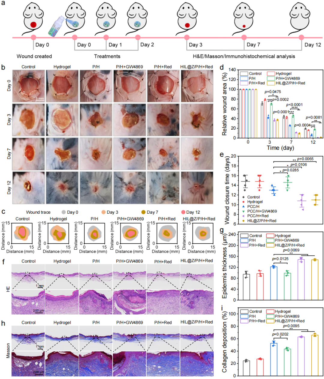 促愈凝胶怎么排出西南交大周绍兵／侯建文团队《Nat. Commun.》：“一箭三雕”- 具有防复发、抑转移、促愈合功能的自产氧纳米复合水凝胶_https://www.jmylbn.com_新闻资讯_第7张