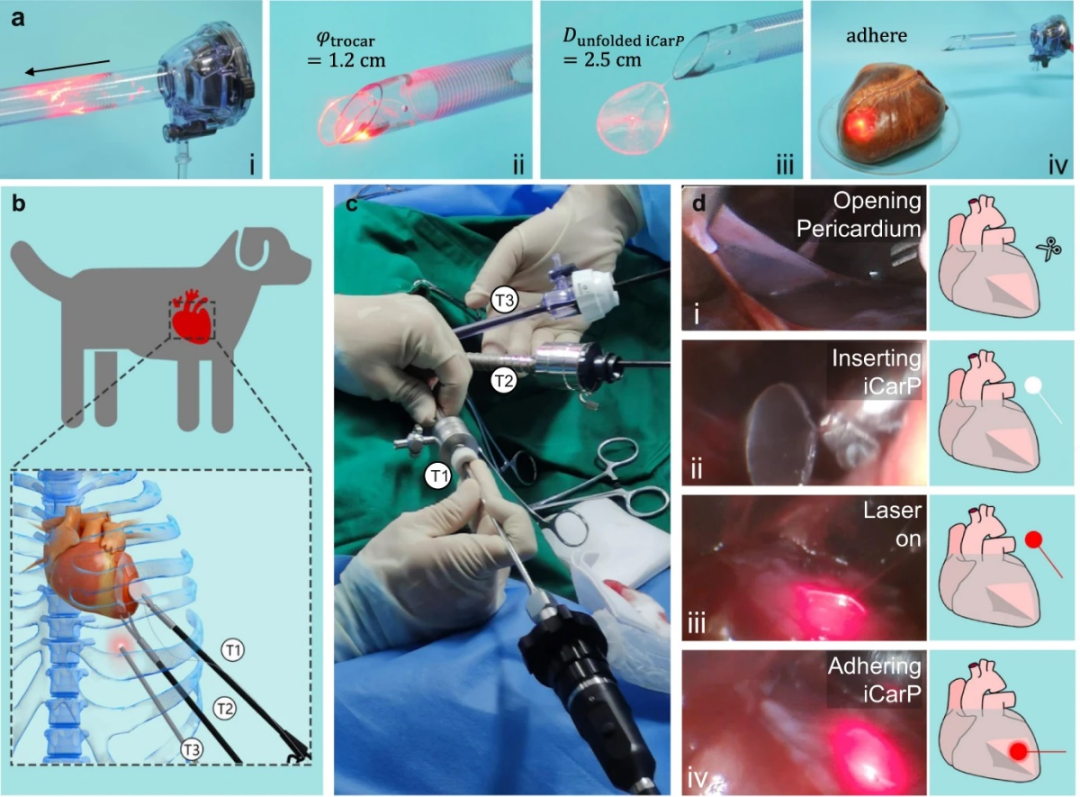 4006B光疗怎么用浙江大学朱旸研究员、张磊教授、高长有教授、周民研究员团队合作 Nat. Commun.： 可生物降解的柔性导光贴片用于体内光疗_https://www.jmylbn.com_新闻资讯_第7张