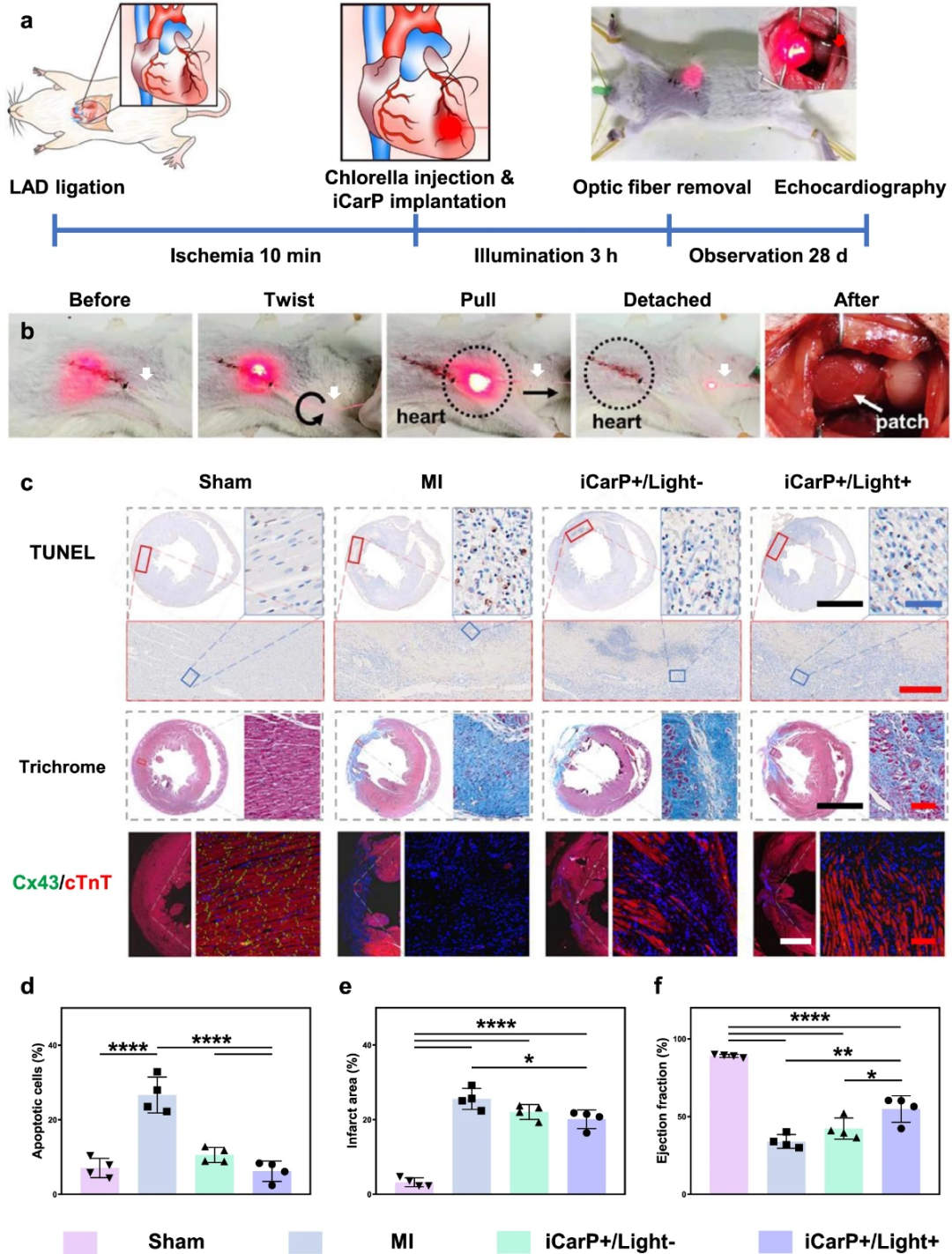 4006B光疗怎么用浙江大学朱旸研究员、张磊教授、高长有教授、周民研究员团队合作 Nat. Commun.： 可生物降解的柔性导光贴片用于体内光疗_https://www.jmylbn.com_新闻资讯_第6张
