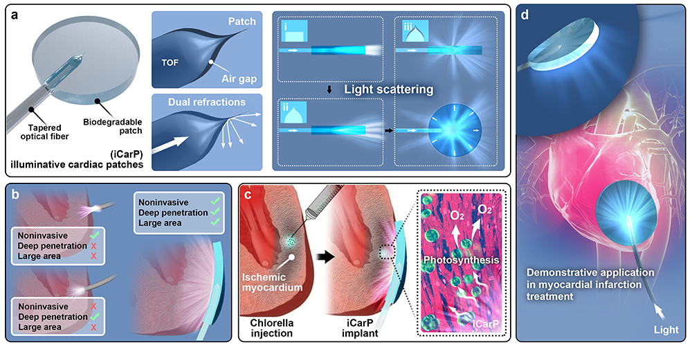 4006B光疗怎么用浙江大学朱旸研究员、张磊教授、高长有教授、周民研究员团队合作 Nat. Commun.： 可生物降解的柔性导光贴片用于体内光疗_https://www.jmylbn.com_新闻资讯_第4张