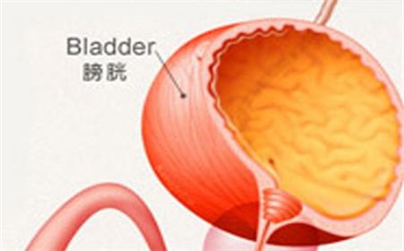 b膀胱镜为什么消毒科普 ｜ 膀胱镜检_https://www.jmylbn.com_新闻资讯_第4张