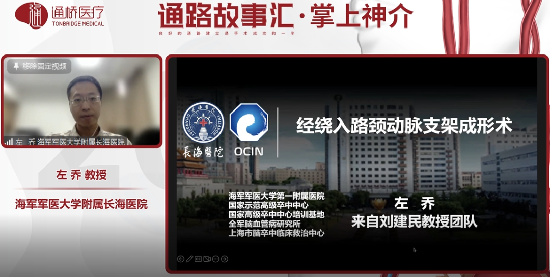 桡动脉鞘怎么读《经桡动脉入路神经介入诊疗中国专家共识》重磅发布！_https://www.jmylbn.com_新闻资讯_第13张