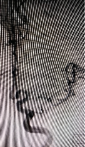 导丝怎么扩【载药时代 球扩天下】NOVA DES®颅内药物洗脱支架在大脑中动脉重度狭窄中的应用两例！_https://www.jmylbn.com_新闻资讯_第16张