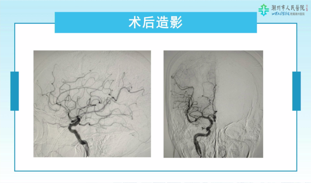 image22.png