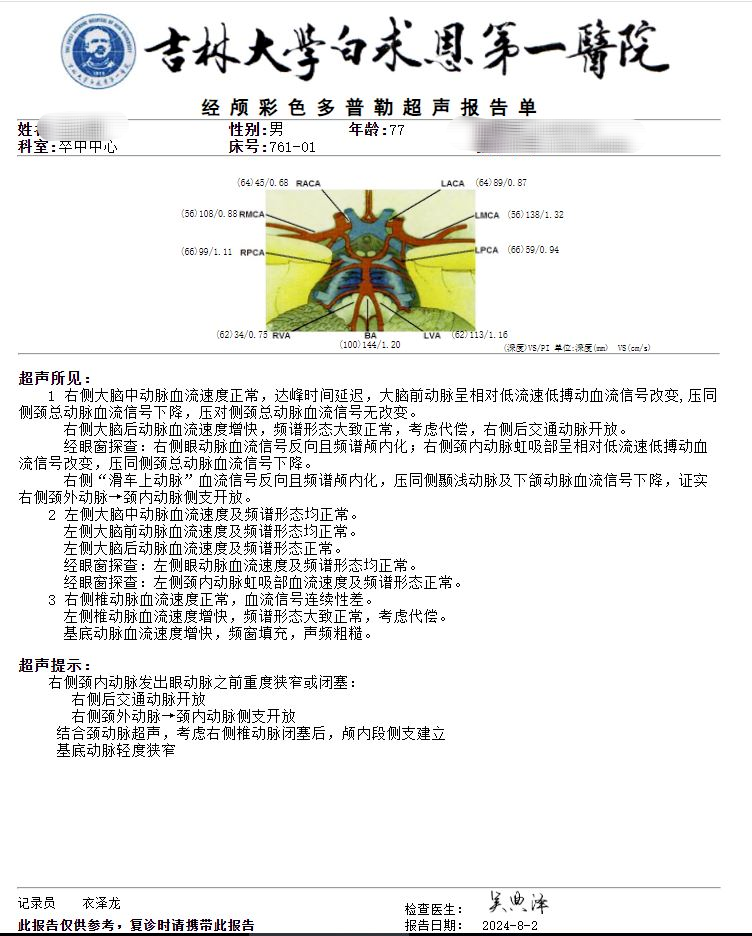 什么叫桡鞘【例久弥新】寻道于桡——瑞康通5.5F Introsky X导管鞘经桡入路治疗颈动脉重度狭窄一例_https://www.jmylbn.com_新闻资讯_第14张