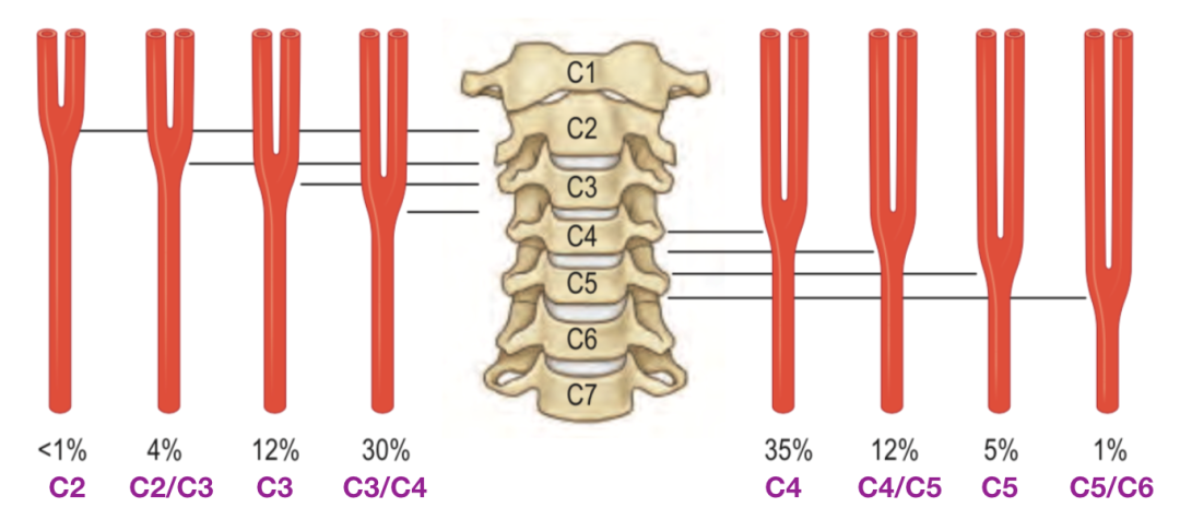 动脉鞘怎么画脑血管解剖学习笔记第29期：颈动脉鞘_https://www.jmylbn.com_新闻资讯_第8张