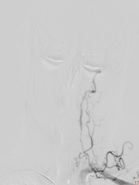 image14.png