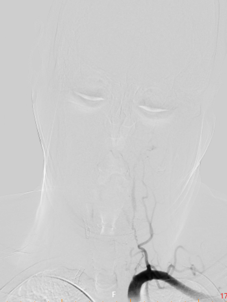 image13.png