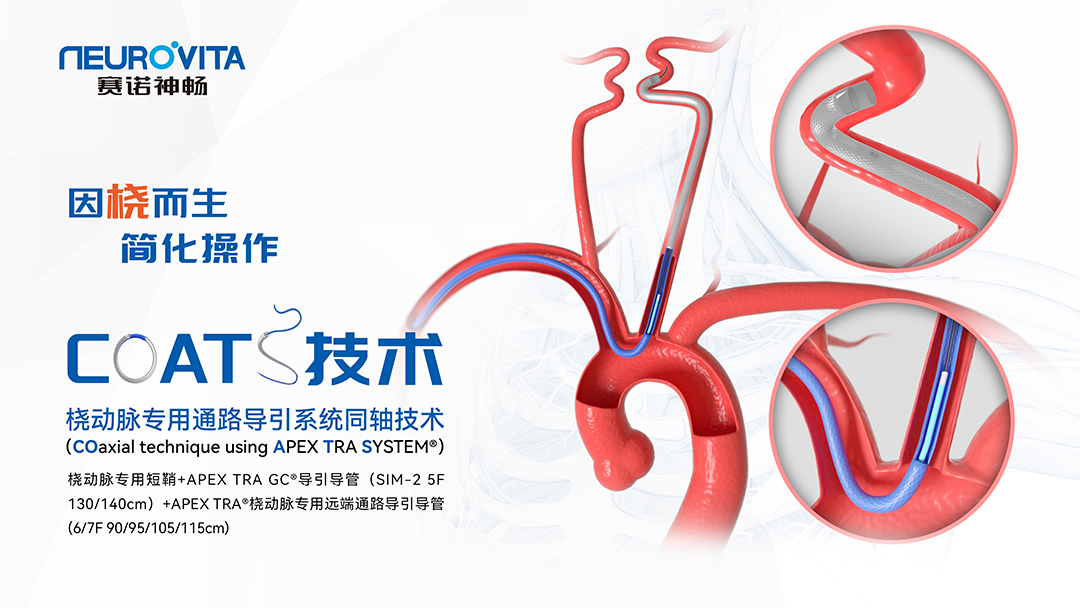 泥鳅导丝怎么用因桡而生 与众不同丨COATS桡动脉专用通路导引系统同轴技术详解_https://www.jmylbn.com_新闻资讯_第1张