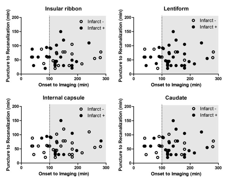 累及豆纹动脉的急性缺血性卒中血管内再通成功后对基底节损伤的影响 神介资讯 微信公众号文章阅读 Wemp