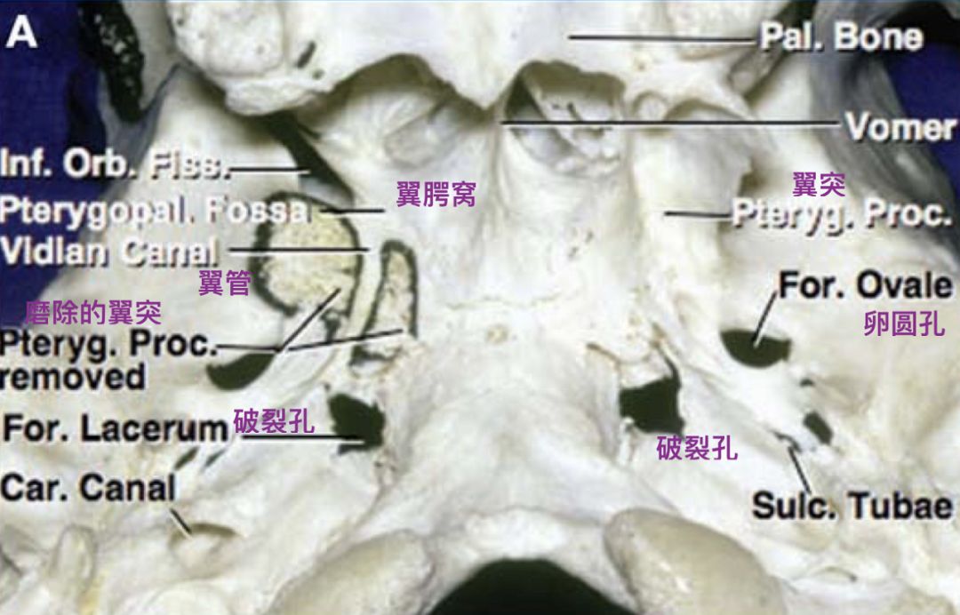 翼管解剖位置图图片